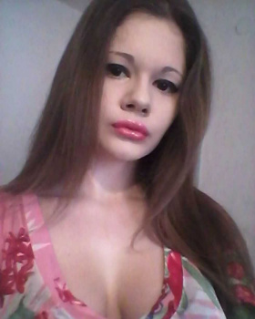 【画像】女の子、整形してセクシーな唇を手に入れるｗｗｗの画像