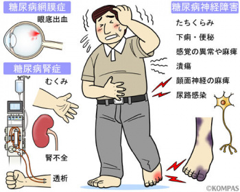 【画像】糖尿病の視界、怖すぎるｗｗｗの画像