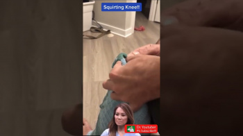 It Is Like Fountain shorts blackheads TikTok cystの画像