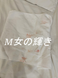 性的トラウマを抱えた20歳女性の処女卒業体験談｜怖さと向き合った一日の画像