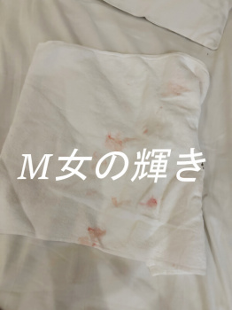 性的トラウマを抱えた20歳女性の処女卒業体験談｜怖さと向き合った一日の画像