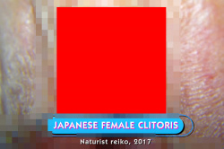 【動画有り】女医「これは日本人女性のクリトリスです」海外の性教育系動画で何故か日本人女性のクリトリスが公開されてしまうｗｗｗｗ【sexplanations】の画像