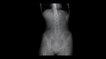 【youtube】 レントゲンでマ●コが丸見えｗｗｗｗｗｗ（動画あり）の画像