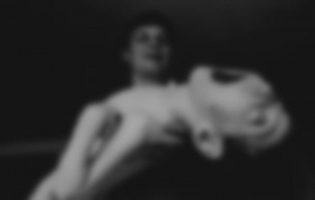 【閲覧注意】チェルノブイリで突然変異によって生まれた子供たちの画像ってガチなの？の画像