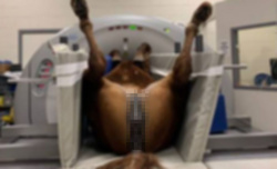 【画像】メスさん、大開脚で検査しているところを撮影されてしまう(モザイク無し)wwwwwwwの画像