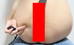 【閲覧注意】まんさん、セッ〇スのやりすぎでアソコがとんでもないことになる?!!!の画像