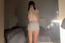 【閲覧注意】中国のパパ活女子(15)、性病に感染しヤバイ事にｗｗｗｗｗの画像