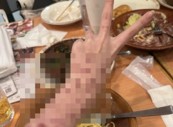 【閲覧注意】この少女、今までどんな人生歩んできたんだろう・・・。の画像