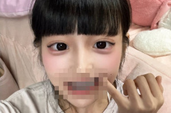 【画像】歯を全部銀歯にした女さん、発見されるｗｗｗｗｗｗｗｗｗｗｗの画像
