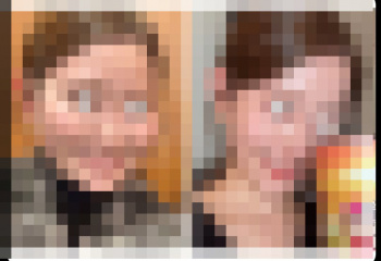【画像】女性さん、鼻の整形で一気に垢抜けるｗｗｗｗｗｗｗｗｗｗｗｗｗｗｗの画像