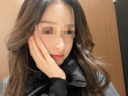 【画像】マスク美女「あたし、石原さとみに似てるって毎日言われてましたw」←マスク取った結果…の画像