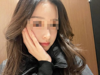 【画像】マスク美女「あたし、石原さとみに似てるって毎日言われてましたw」←マスク取った結果…の画像