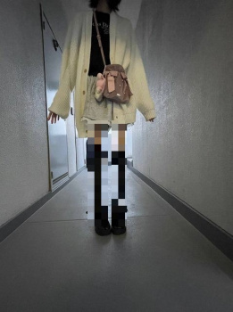 【衝撃画像】ガリガリすぎるパパ活女子が発見されるの画像
