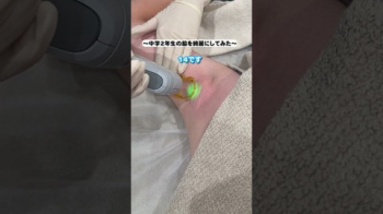 【youtube】女子中学生の腋脱毛の画像