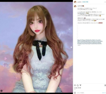 3億円整形まんさん｢どうしてもフランス人形になりたい。｣医師｢日本人はフランス人形にはなれません。｣の画像