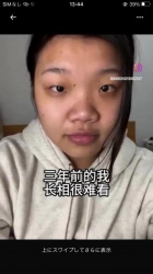【画像】中国まんさん、韓国で大手術して超絶美女になる。想像の5倍美人の画像
