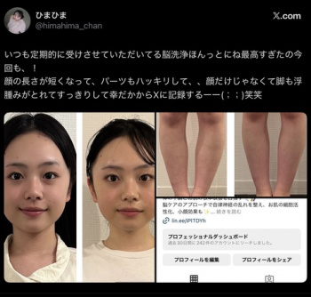 【画像】JK「脳洗浄ほんっとにね最高すぎる！顔が短くなって、足がスッキリするの?✨」の画像