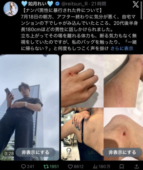 【動画】暑さでぐったり座り込んでいる女の子にナンパしながら盗撮。女の子が撮り返すと暴行。の画像