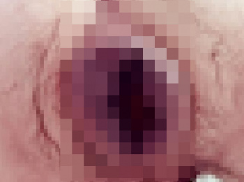 ★【超！閲覧注意】Ｈしまくってたら（お尻の）穴がぶっ壊れた…ちょっとこれ見て…（画像あり）の画像
