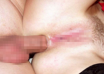 ★【衝撃アナルセックス】肛門内に取り付けた高性能カメラがとらえたアナル中出しSEXが衝撃過ぎる!!の画像