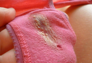 激臭間違いなしの汚いパンツ画像!閲覧注意かもしれないwの画像