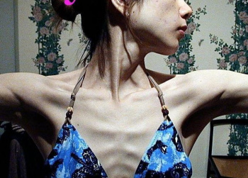 鎖骨フェチにはたまらないがりがりな女の子のエロ画像!30kgないんじゃないかwの画像