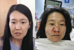 【悲報】日本人女性、アメリカでいきなりぶん殴られて入院wywywywywyの画像