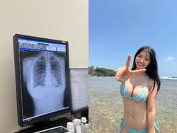 巨乳グラドル豊島心桜がエッチな乳丸出しレントゲン写真を公開の画像